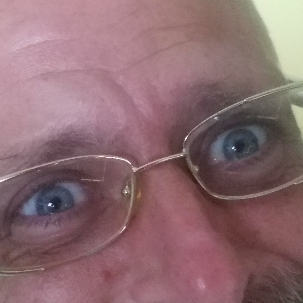 Fendi RX Glasses - Picture 3 of 8